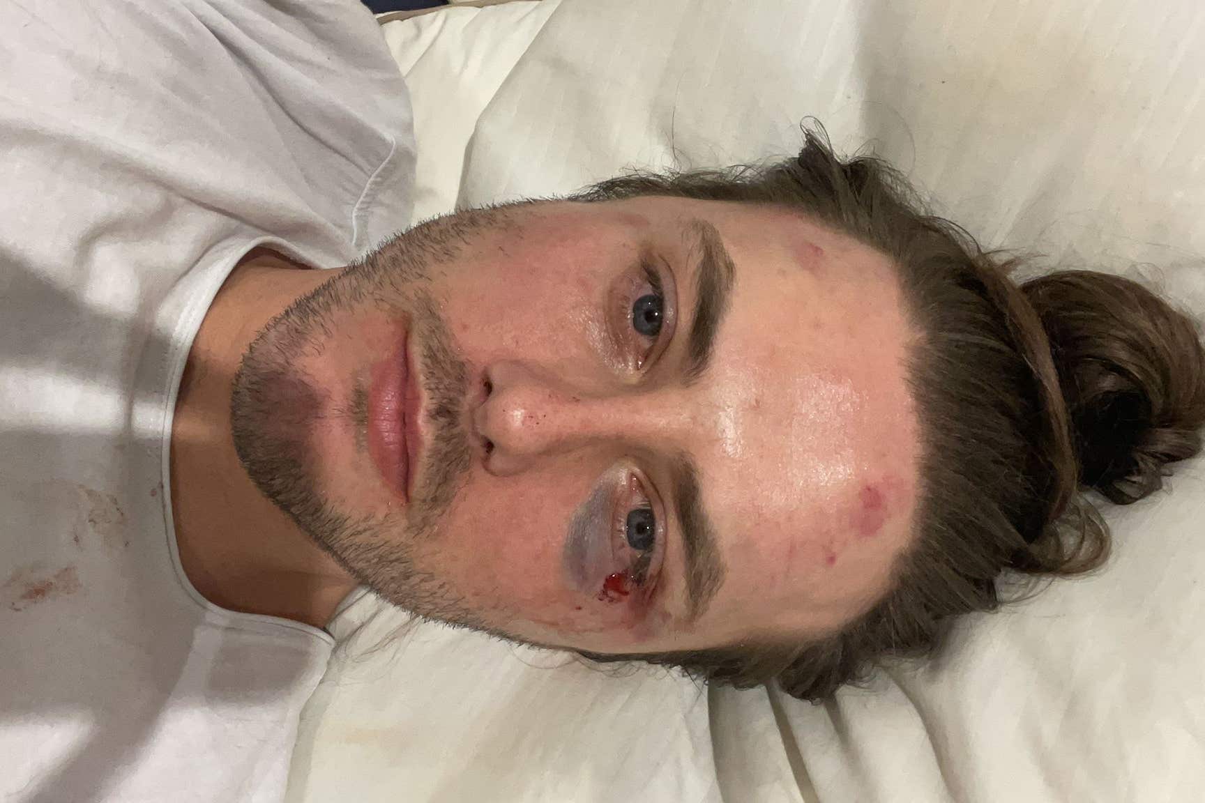 Homophobia always 'bubbling under the surface', says Tube attack victim - Vimarsana News